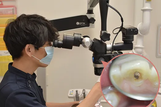歯科用顕微鏡治療装置
