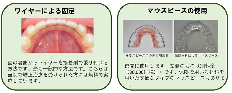 矯正治療後の保定