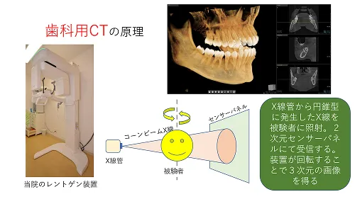 歯科用CT