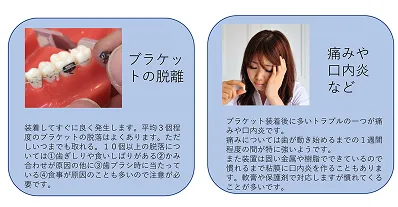 マルチブラケット治療